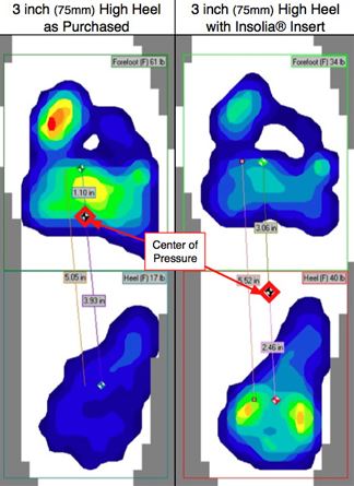 Como funciona Palmilha Insolia - uma perspectiva médica